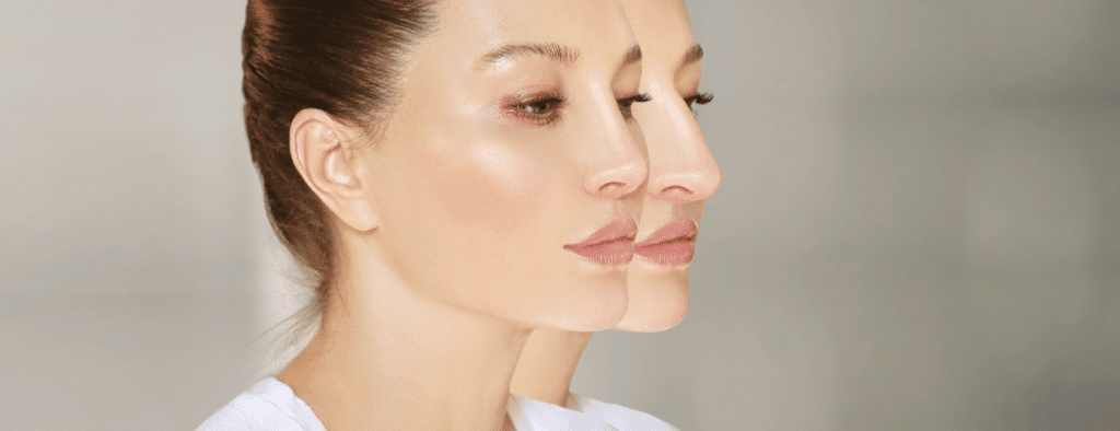 Une rhinoplastie pour vous faire opérer du nez